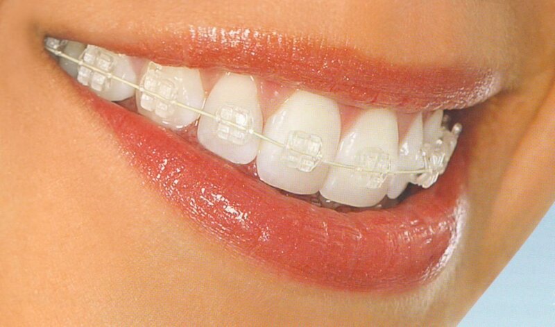 Dental 22 - Clinica Stomatologica Bucuresti