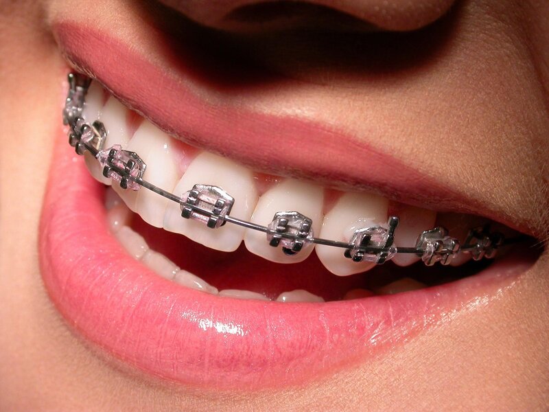 Dental 22 - Clinica Stomatologica Bucuresti