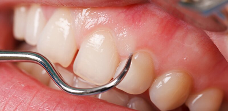 Dental 22 - Clinica Stomatologica Bucuresti