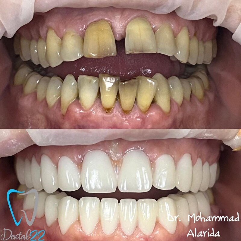 Dental 22 - Clinica Stomatologica Bucuresti