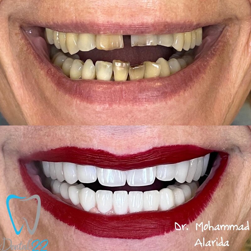 Dental 22 - Clinica Stomatologica Bucuresti